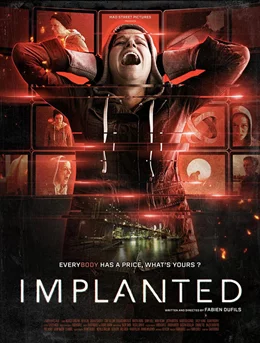 Implanted / Имплантирани 